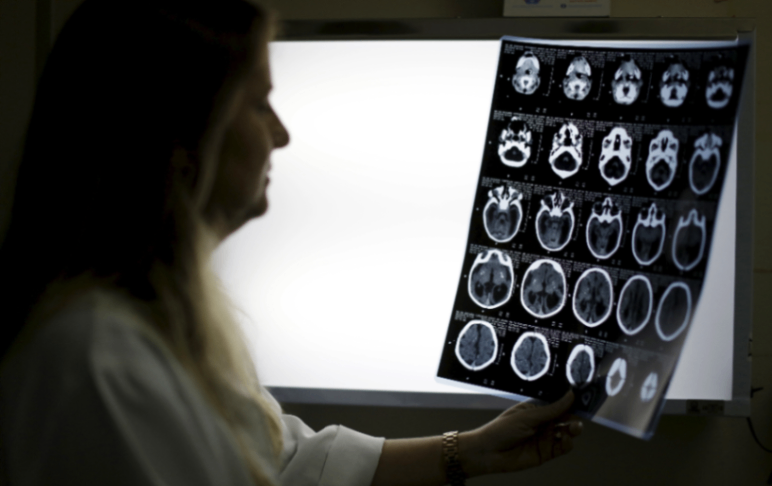  أضرب خبراء الأشعة في انجلترا