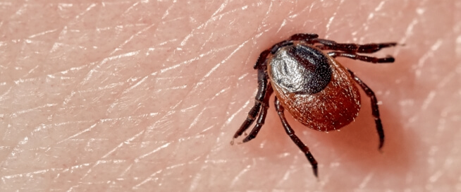 تسببت لدغة القراد في حساسية قاتلة ، تاركة كريستوفر ، 28 عامًا ، في المنزل