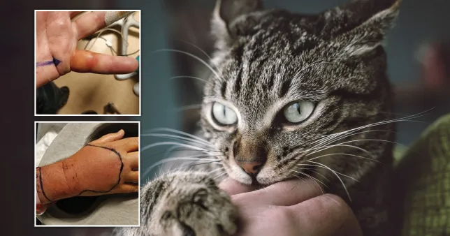 بسبب عضة قطة ورجل يعاني من عدوى غامضة وغير معروفة