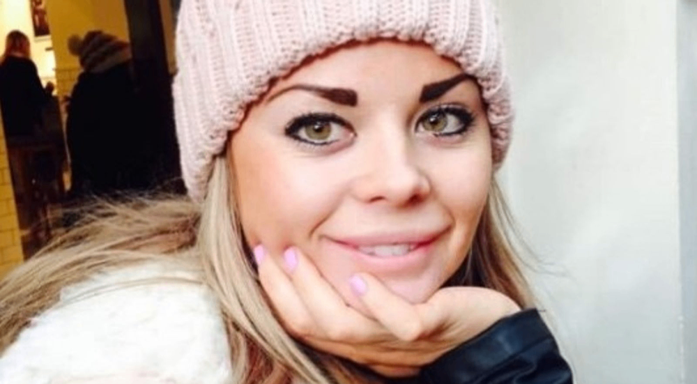 وفاة امرأة بريطانية بعد عملية شد الأرداف