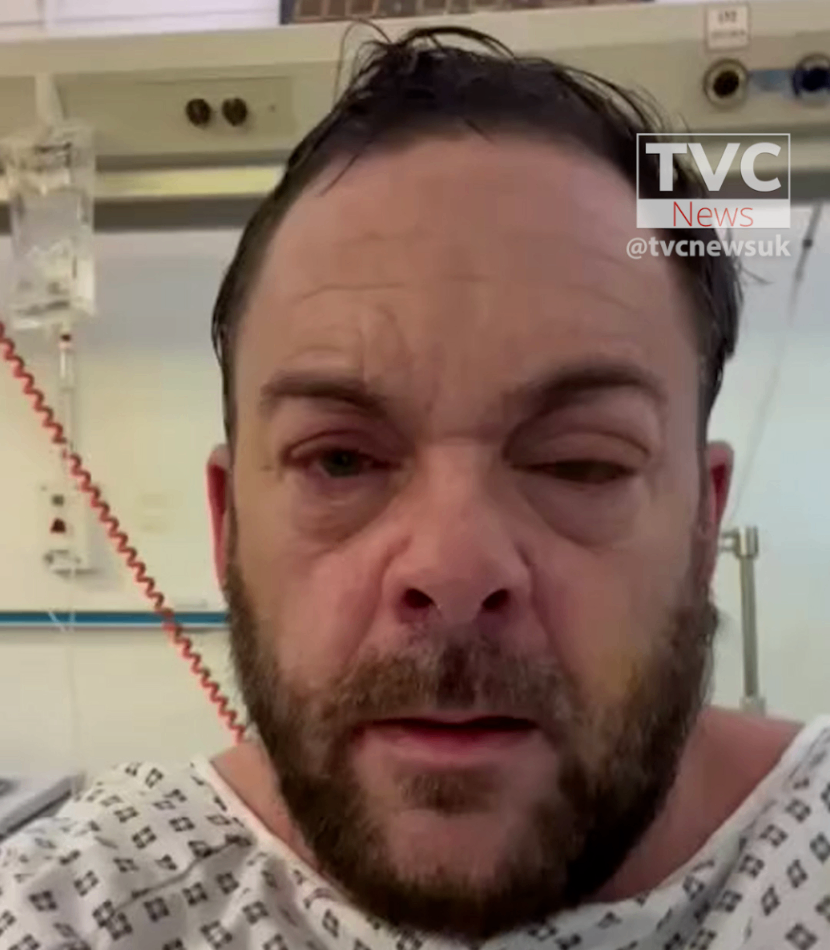 اسپری آمونیاک به صورت راننده ای در لندن