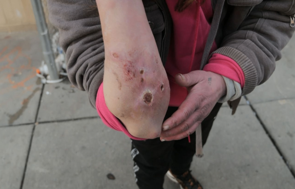 هشدار کارشناسان به نفوذ 'مواد مخدر زامبی' در بازار بریتانیا